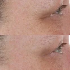 Perricone MD High Potency Retinol Recovery Overnight Moisturizer (Various Sizes) 7 Perricone MD High Potency Retinol Recovery Overnight Moisturizer (Various Sizes) -Anastasia Beverly Hills Sales 14609564 6955047298147358